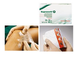 MEDICAZIONE STERILE IN FILM IN POLIURETANO TRASP. SUPRASORB F 10X12CM 10 PEZZI - Luckyfarma.it